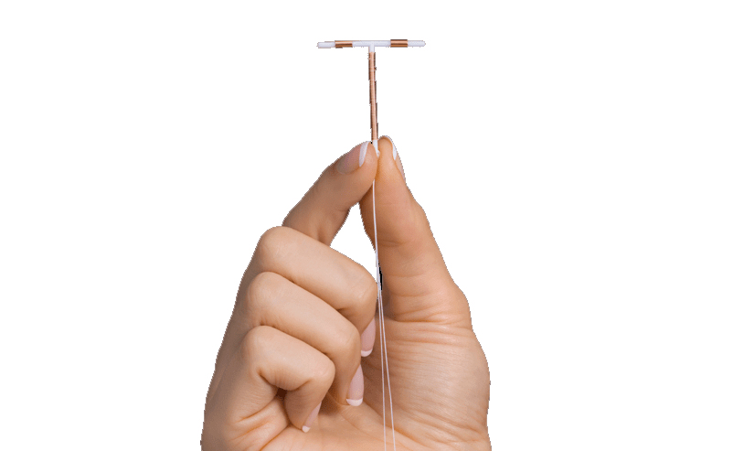 Copper Paragard IUD that failed